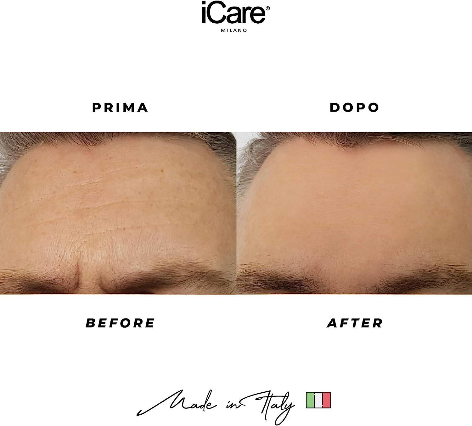 iCare Patch Microaghi Fronte 1 pezzo - Jasmine Parfums- [ean]